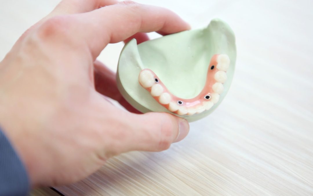 Formação de implantologia dentária